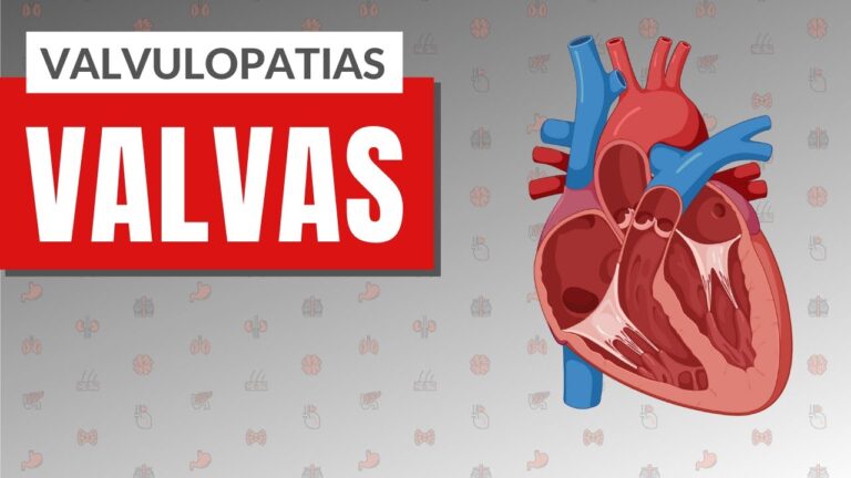 Valvopatias: A jornada do paciente
